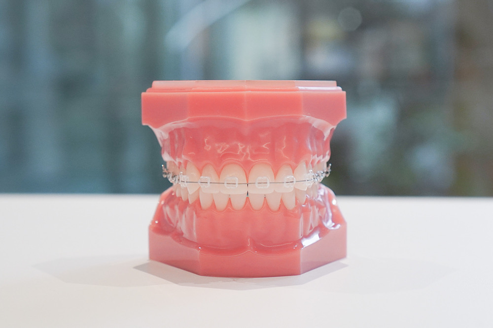 新座|荻島歯科医院アネックスの矯正治療