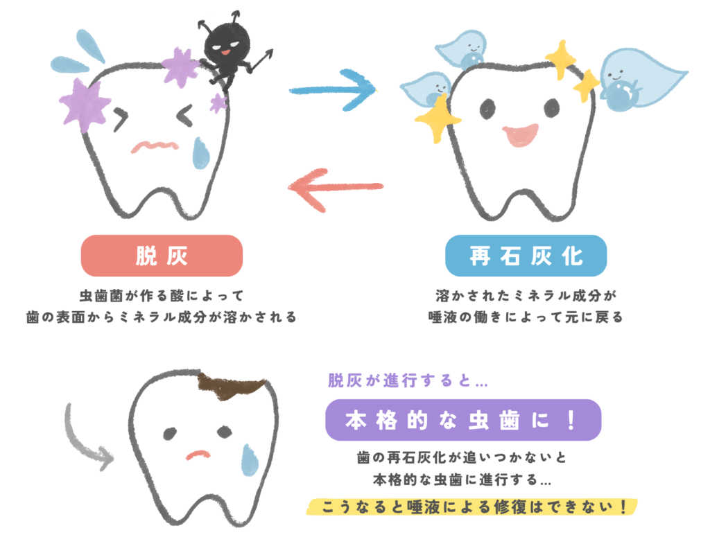 脱灰ー再石灰化のサイクル